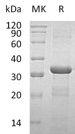 Recombinant Human CORO6 (N-6His)