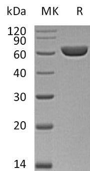 Recombinant Mouse CES3 (C-6His)
