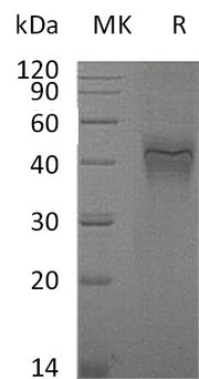 Recombinant Mouse IFNGR1 (C-6His)