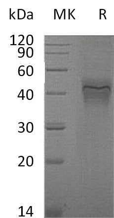 Recombinant Mouse IFNGR1 (C-6His)