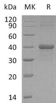 Recombinant Mouse Carbonic Anhydrase 14 (N-6His)