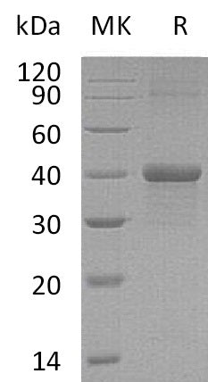 Recombinant Mouse Carbonic Anhydrase 14 (N-6His)