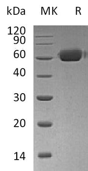 Recombinant Human OPG (C-Fc)