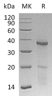 Recombinant Human HOXB4 (L175D, E176K, E178K, N-6His)