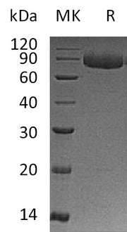 Recombinant Human IL-12RB1 (C-6His)