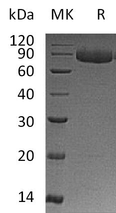 Recombinant Human IL-12RB1 (C-6His)