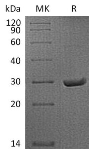 Recombinant Mouse SAP (C-6His)