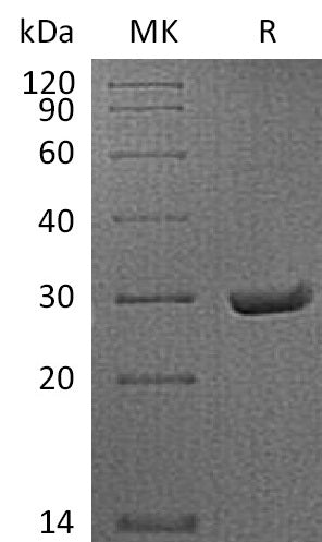 Recombinant Mouse SAP (C-6His)