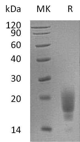Recombinant Mouse TIGIT (C-6His)