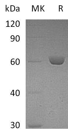 Recombinant Mouse CES2E (C-6His)