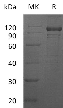 Recombinant Human IL-12RB1 (C-Fc)