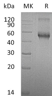 Recombinant Mouse ALK-1 (C-Fc)