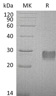 Recombinant Mouse IGFBP-6 (C-6His)