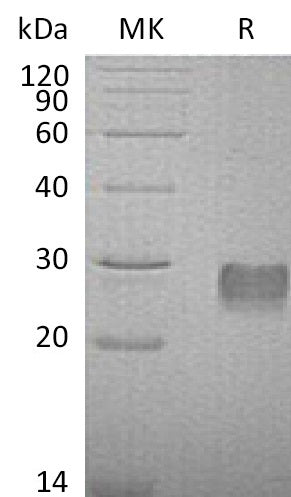 Recombinant Mouse IGFBP-6 (C-6His)
