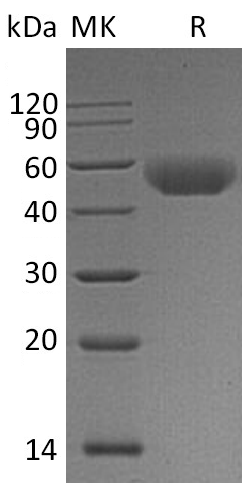 Recombinant Mouse CD5 (C-6His)