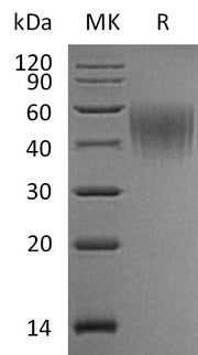 Recombinant Mouse IL-2RA (C-6His)