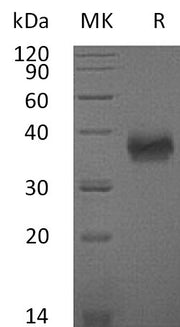 Recombinant Mouse SLAMF5 (C-6His)