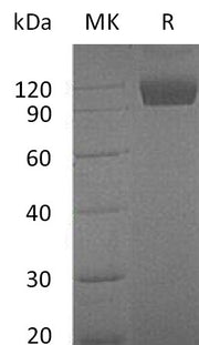 Recombinant Mouse Dtk (C-Fc)