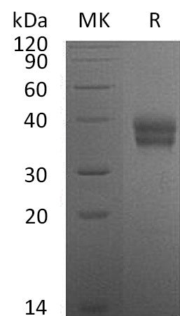 Recombinant Mouse Carbonic Anhydrase 12 (C-6His)