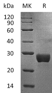 Recombinant Human NKG2DL (C-6His)