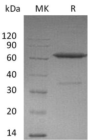 Recombinant Mouse EFNA3 (C-Fc)