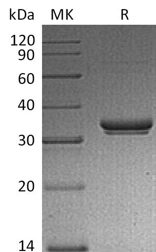 Recombinant Mouse EXTL2 (N-6His)