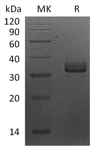 Recombinant Human STX7 (N-6His)