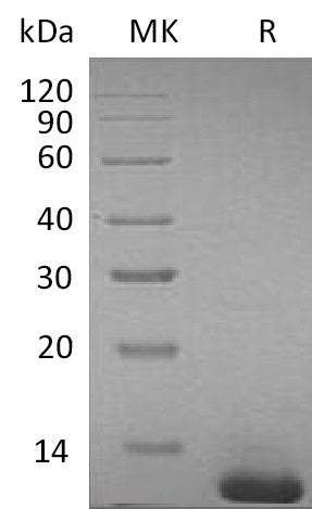 Recombinant Mouse S100B (C-6His)