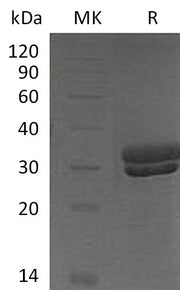 Recombinant Mouse KLK7 (C-6His)