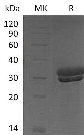 Recombinant Mouse KLK7 (C-6His)