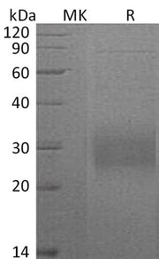Recombinant Mouse CD74 (C-6His)