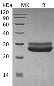 Recombinant Human PRL (C-6His)