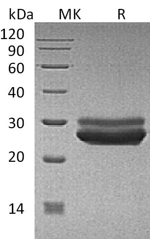 Recombinant Human PRL (C-6His)