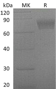 Recombinant Mouse Serpin F2 (C-6His)
