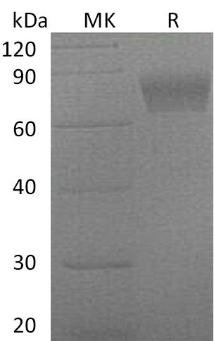 Recombinant Mouse Serpin F2 (C-6His)