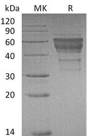 Recombinant Mouse TIM-3 (C-Fc)