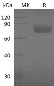 Recombinant Mouse Serpin D1 (C-6His)