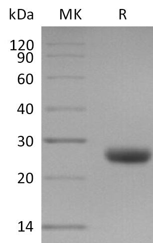 Recombinant Mouse TIMP-1