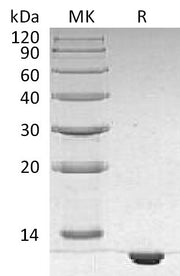 Recombinant Human S100B (N-6His)