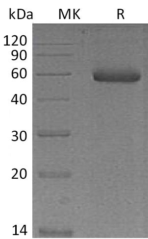 Recombinant Mouse NGAL (C-Fc)