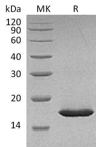 Recombinant Carassiusauratus Leptin (N-8His)