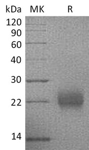 Recombinant Human CGA (C-6His)