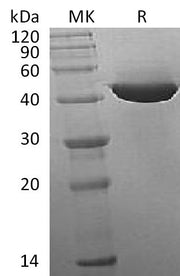 Recombinant Human IDH1 (C-8His)