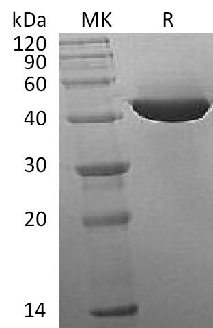 Recombinant Human IDH1 (C-8His)