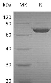 Recombinant Human PGM2 (N-6His)