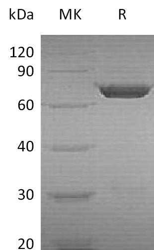 Recombinant Human PGM2 (N-6His)