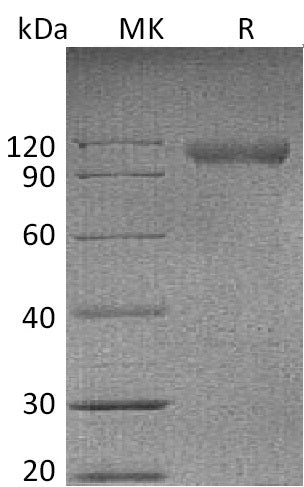 Recombinant Mouse NgR (C-Fc)