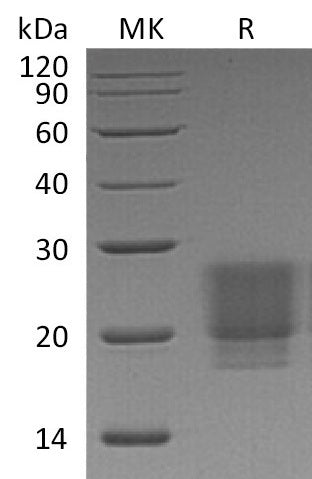 Recombinant Human/Mouse/Rat Irisin (C-6His)