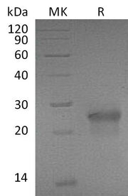 Recombinant Mouse EDA2R (C-6His)