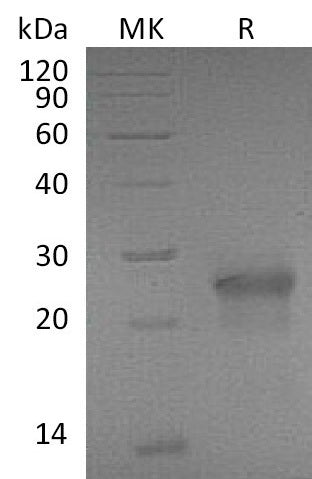 Recombinant Mouse EDA2R (C-6His)